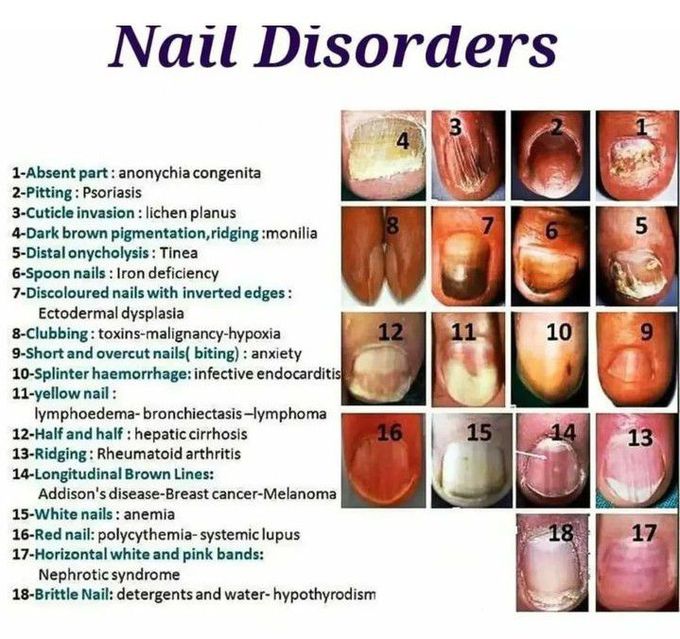 Nail Disorders