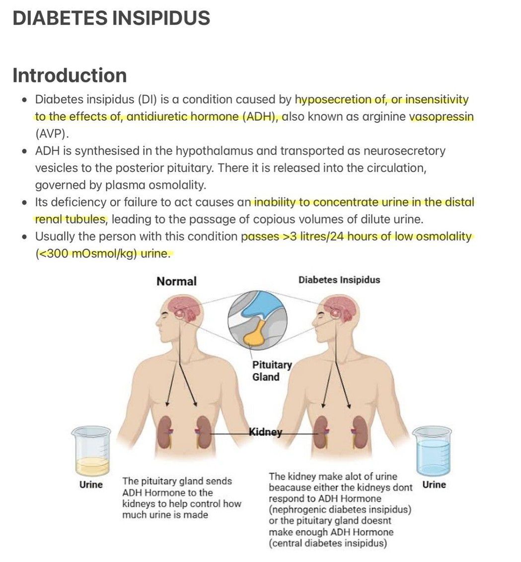 Diabetes Insipidus I   MEDizzy