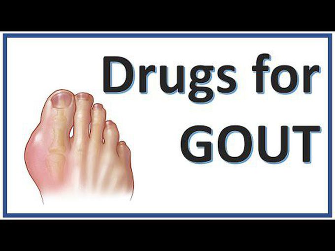 Overview of Anti-Gout Drugs