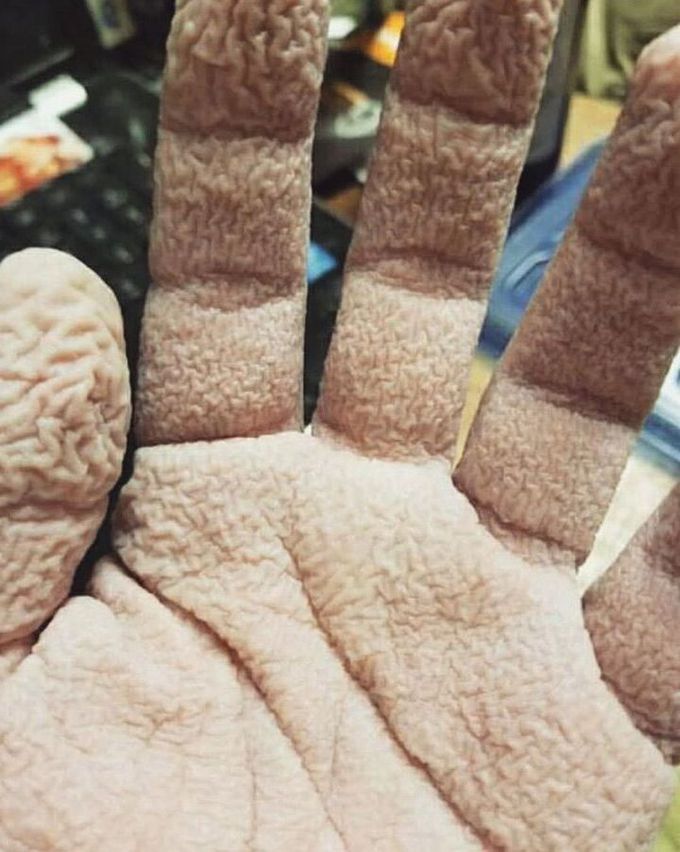 What is the name of this condition and why it’s happening?