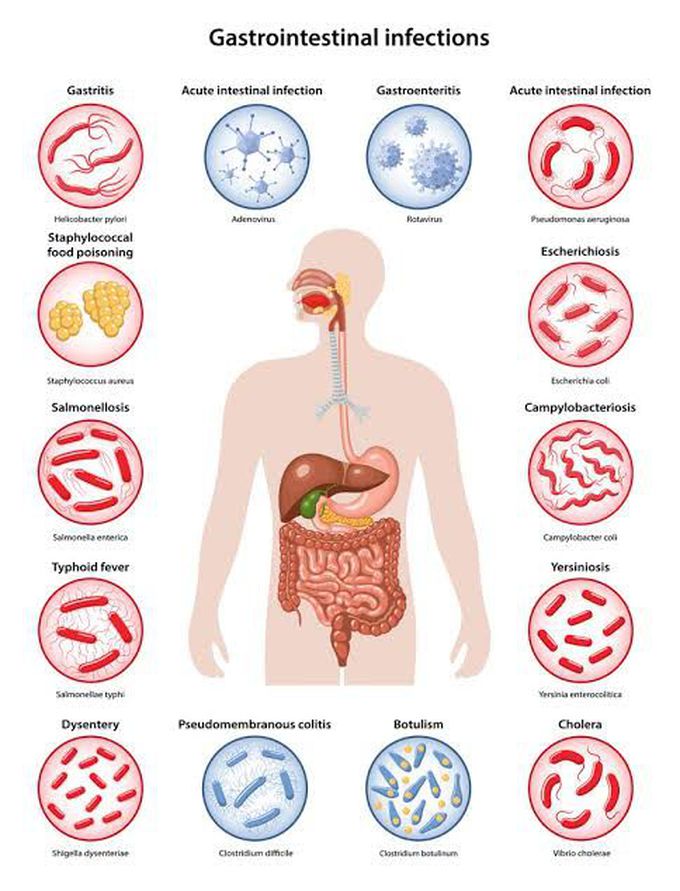 Gastroenteritis symptoms