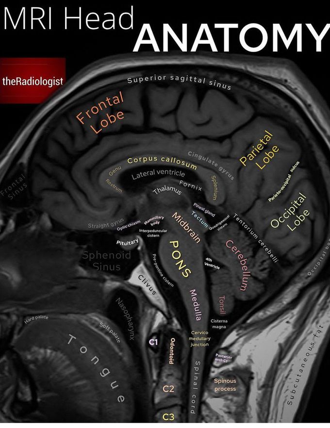 MRI Head Anatomy