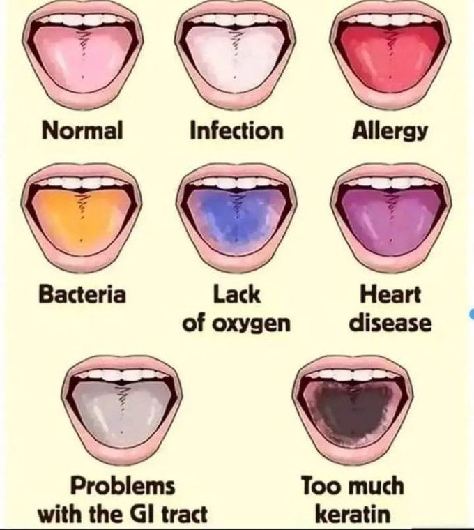 basics-of-oral-pathology-medizzy