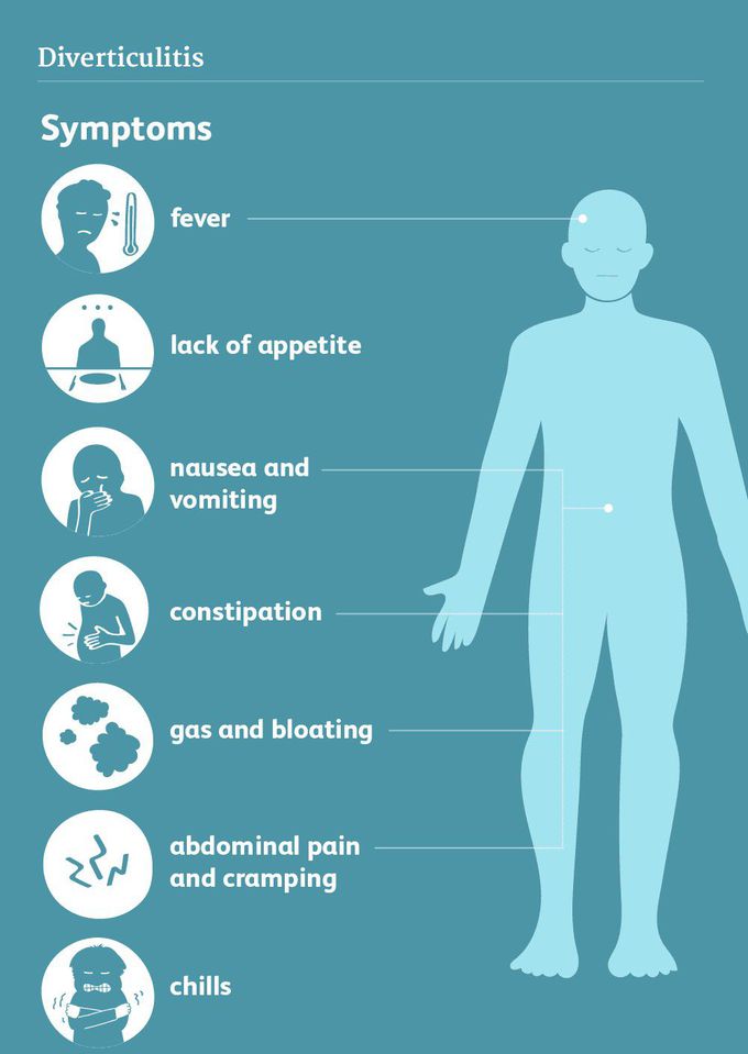 Symptoms of Diverticulitis