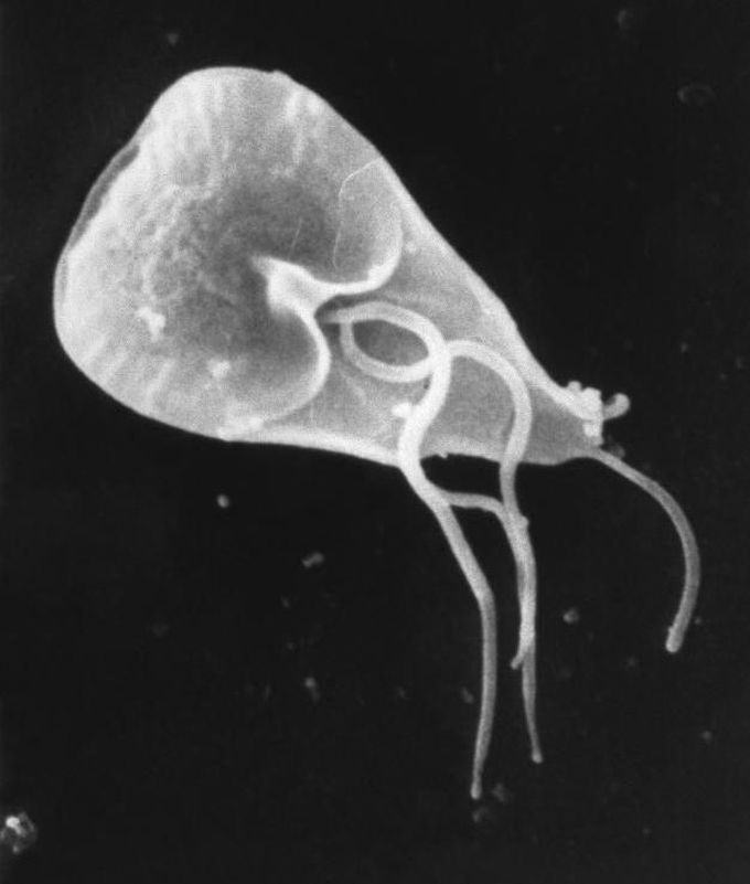 Giardiasis