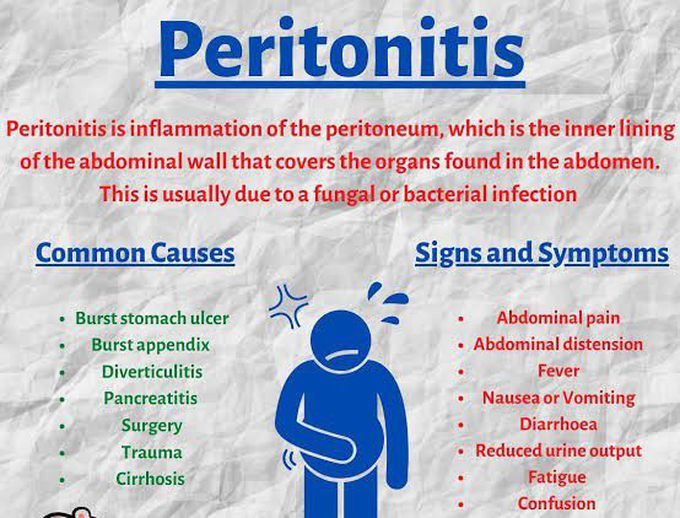 Signs and symptoms of peritonitis