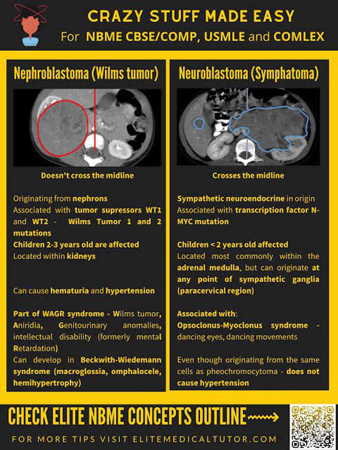 Nephroblastoma Vs neuroblastoma