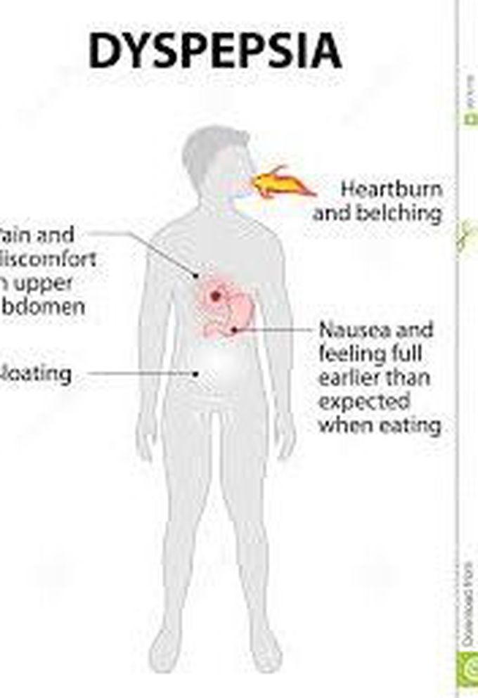 Dyspepsia