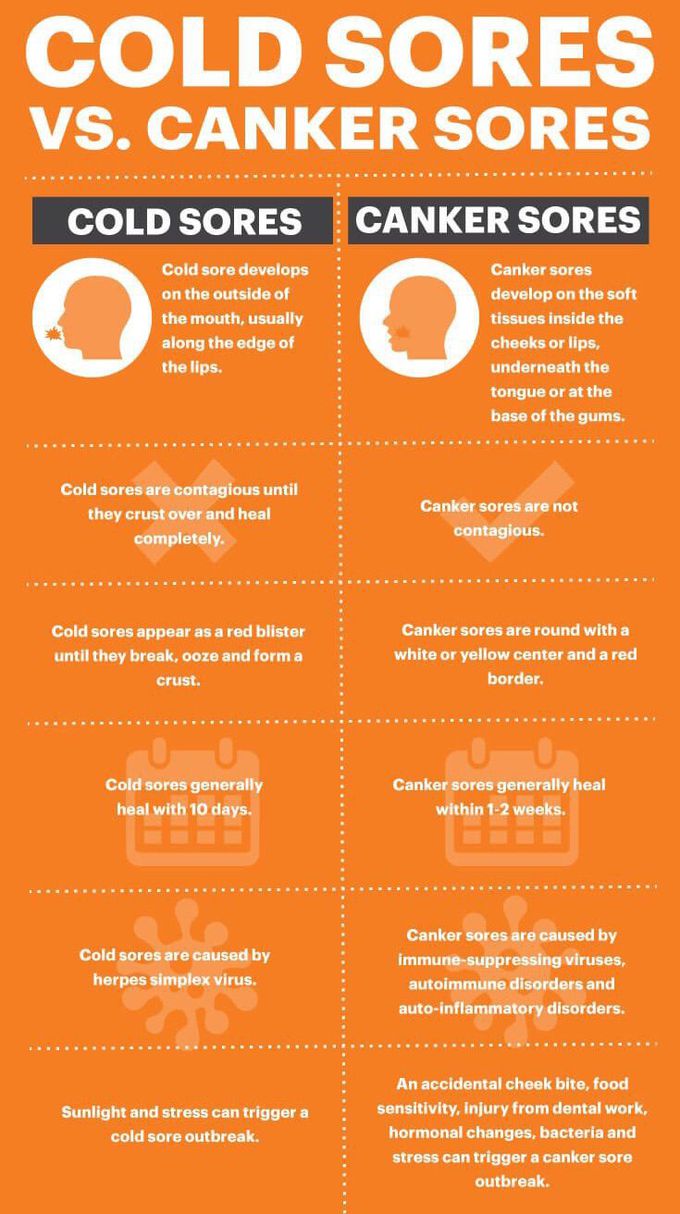 Cold sore vs. Canker sore