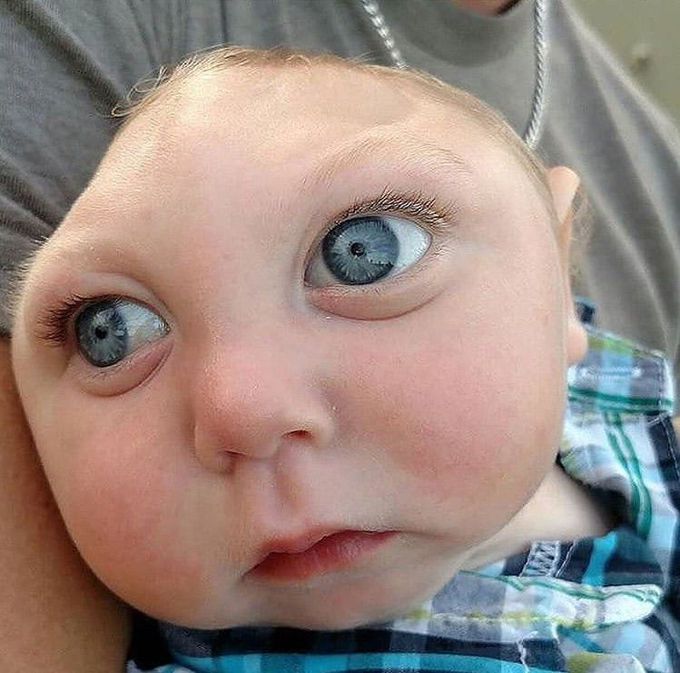 Dx please?, is’t congenital or not