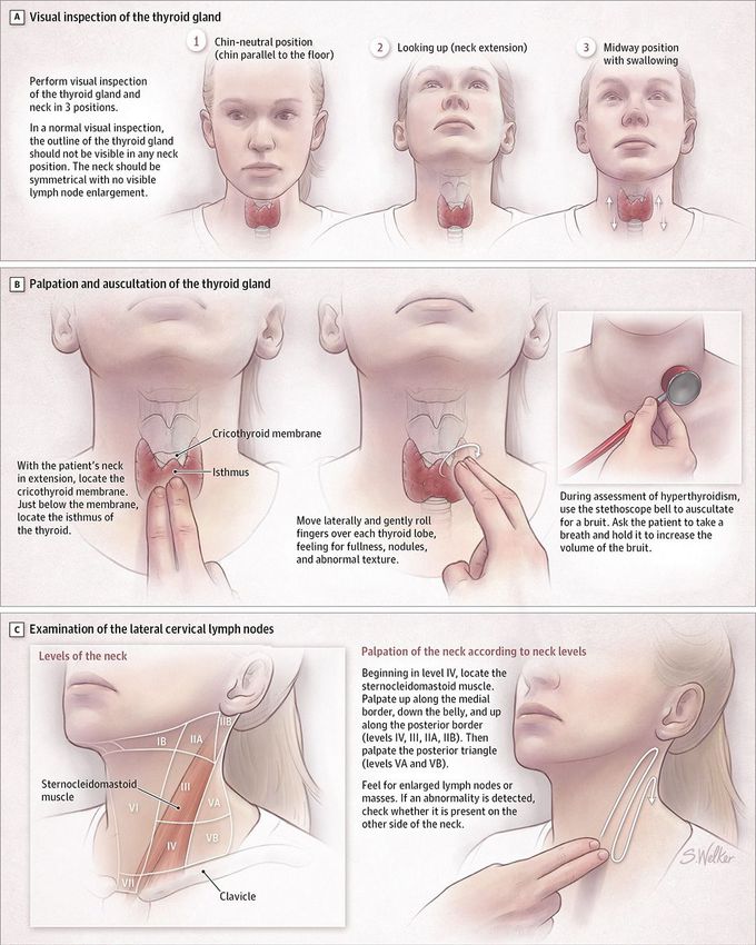 Examination of thyroid gland