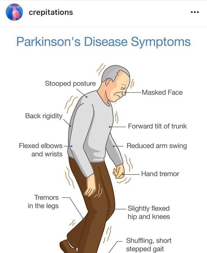 Parkinson’s Disease Clinic