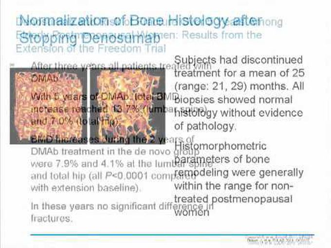 Metabolic Bone Disease - a review