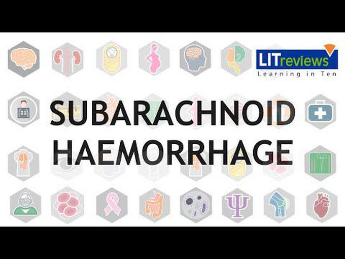 Subarachnoid Hemorrhage: Overview