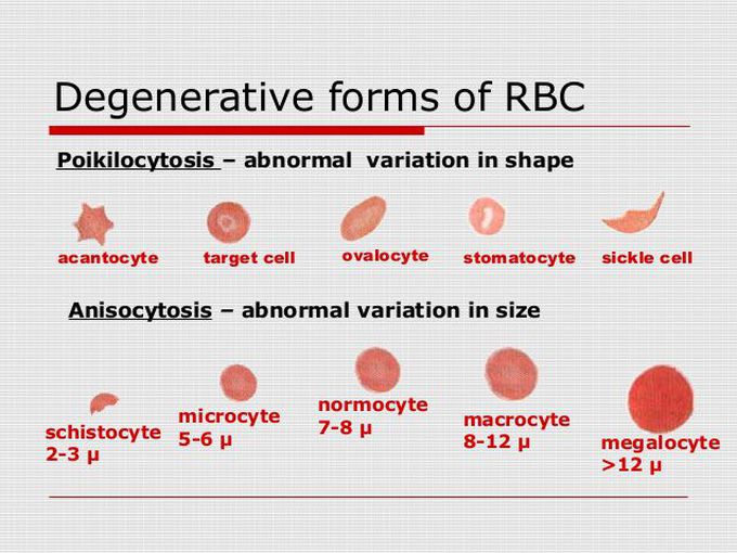 Rbc shape