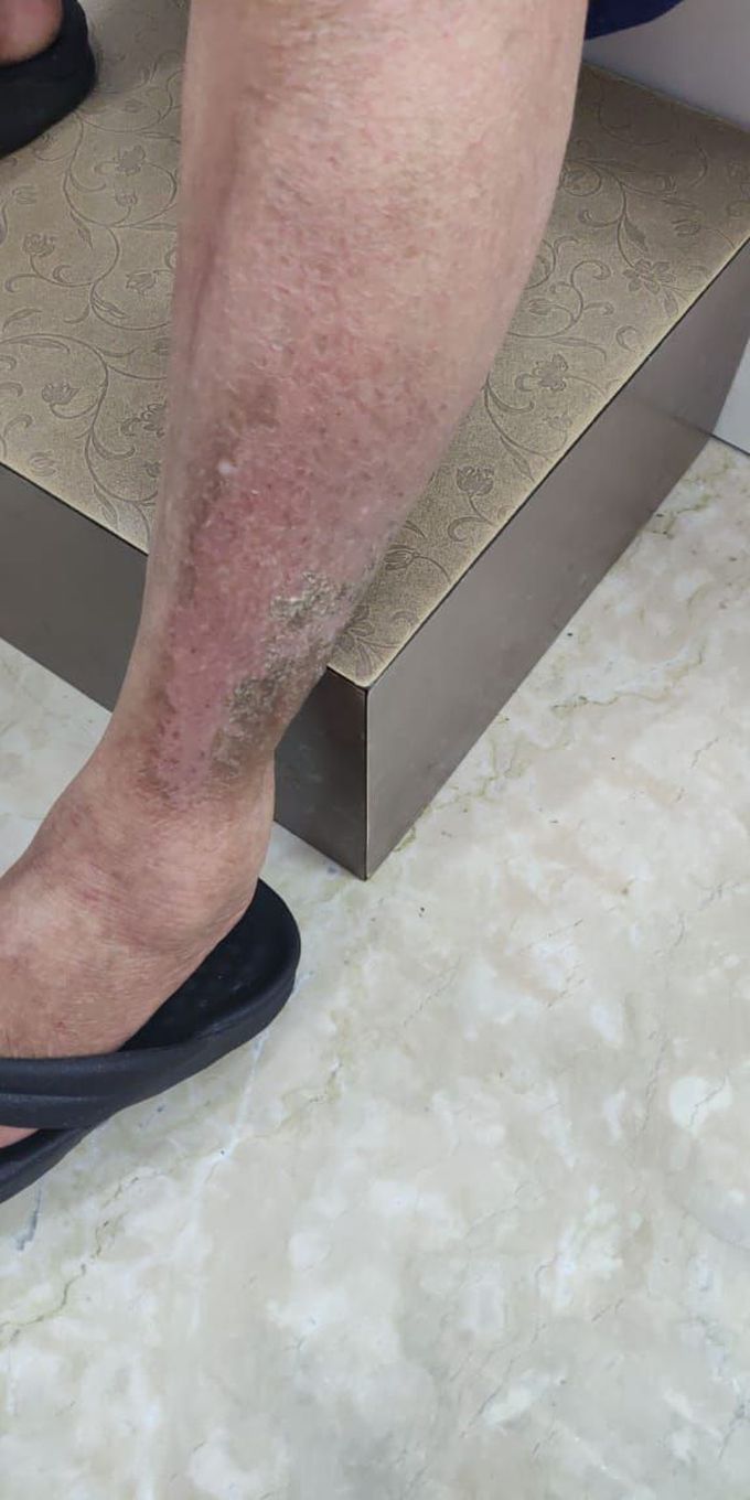 Allergy or something else
