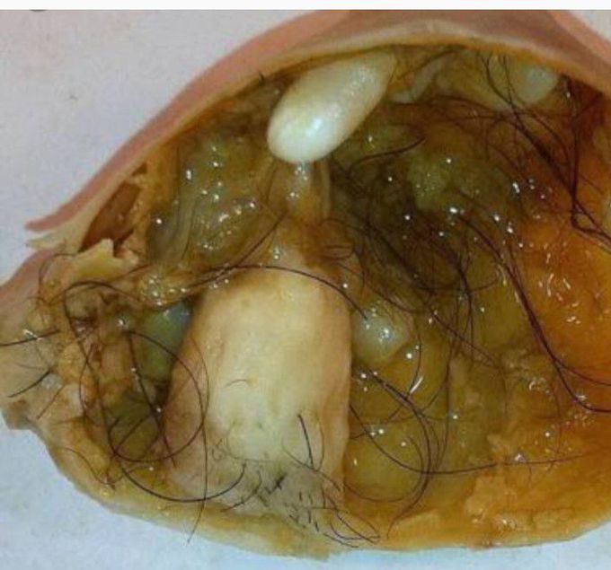 Diagnose..??