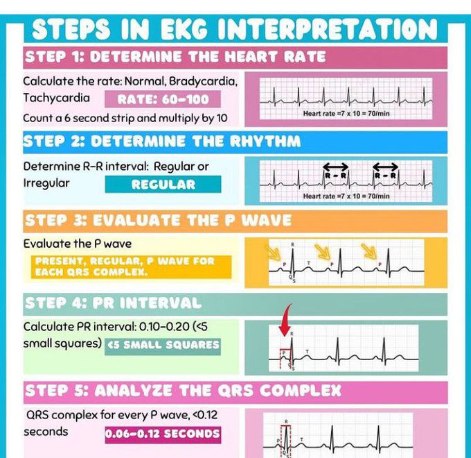 EKG Interpretation