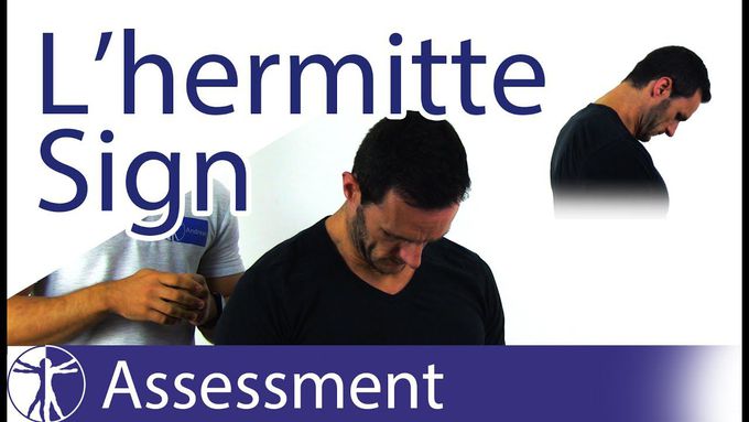 Lhermitte's Sign | Multiple Sclerosis