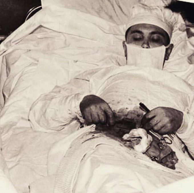 This is Leonid Ivanovich,surgeon.He was struck in cold of ANTARCTICA disturbed by his pain of appendix.So he decided to do his appendicitis operation himself.This is that rare pic through which he tried to amuse us.👌👍