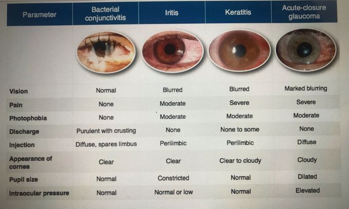 Comparison