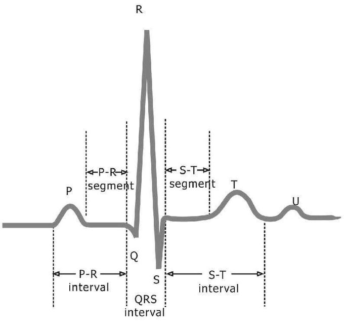 ElectroCardioGram (ECG)