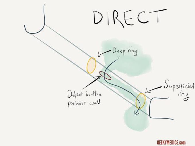 Ring occlusion test