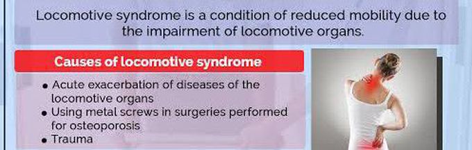 These are the causes of Locomotive syndrome