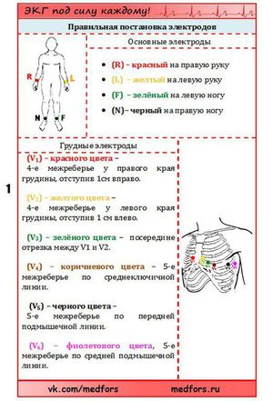 Как снимать экг фото