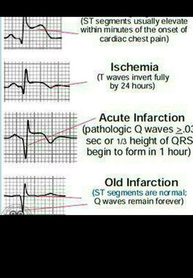 Cardiac