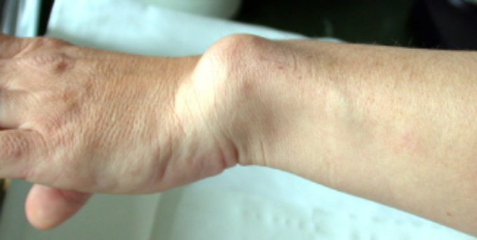 What is your diagnosis