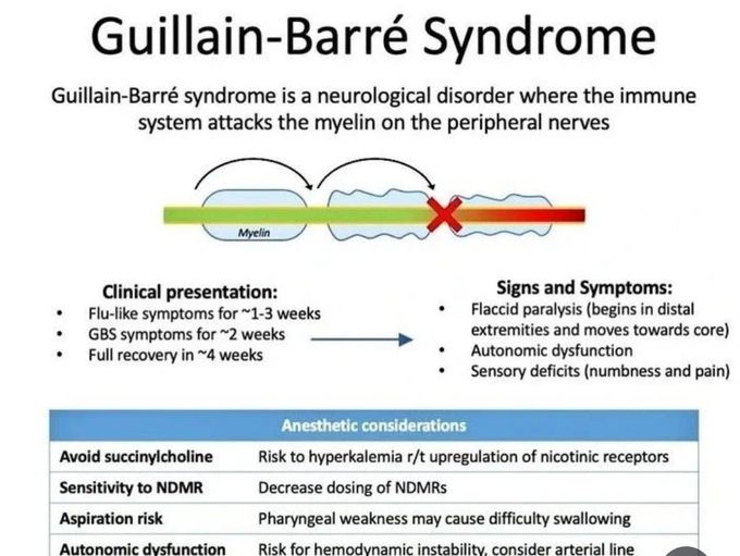 Guilian Barre Syndrome