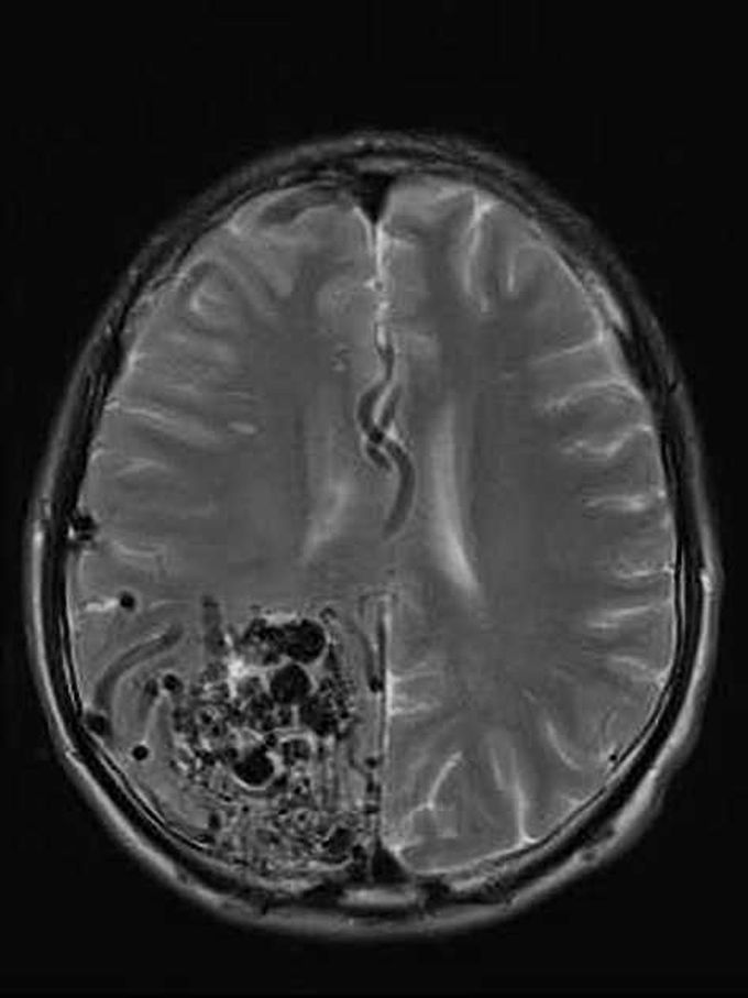 Neuroradiology