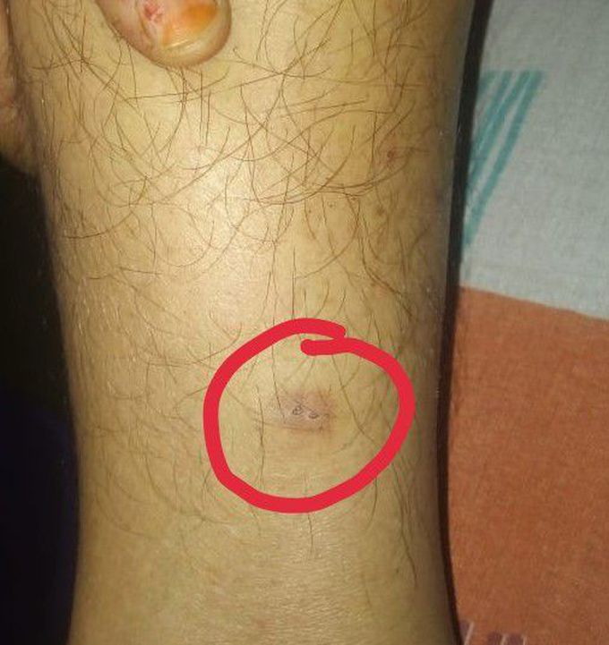 Diagnosis please