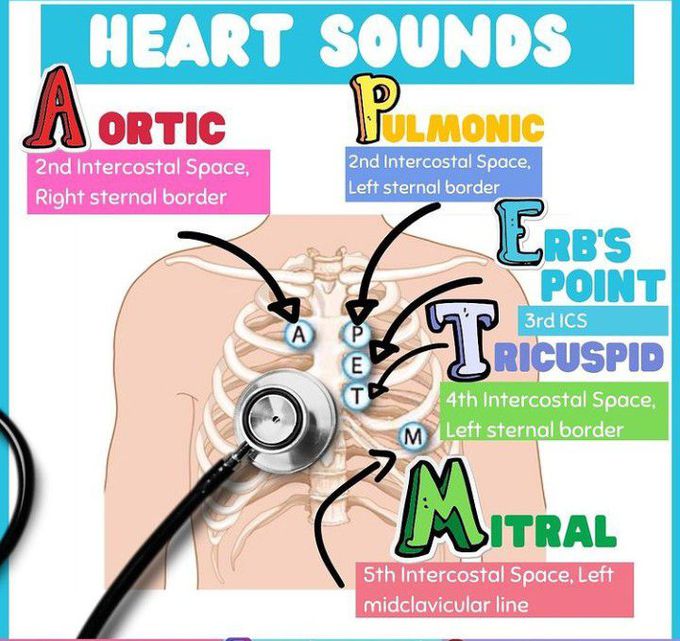 Heart Sounds