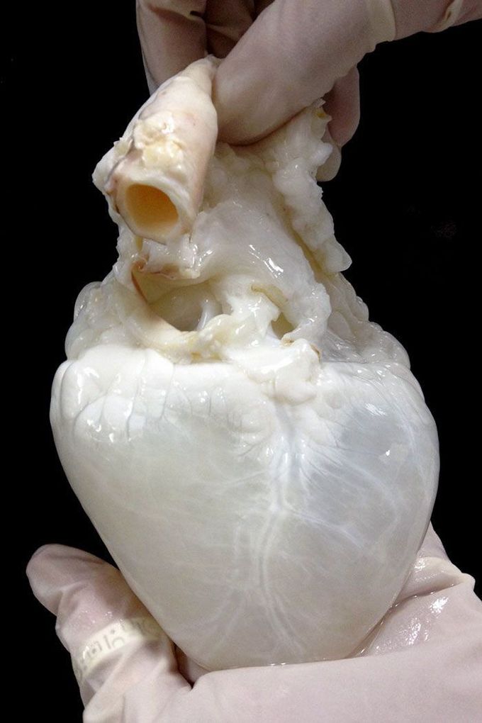 THIS IS HOW A CLEAR HEART LOOKS LIKE ❤️