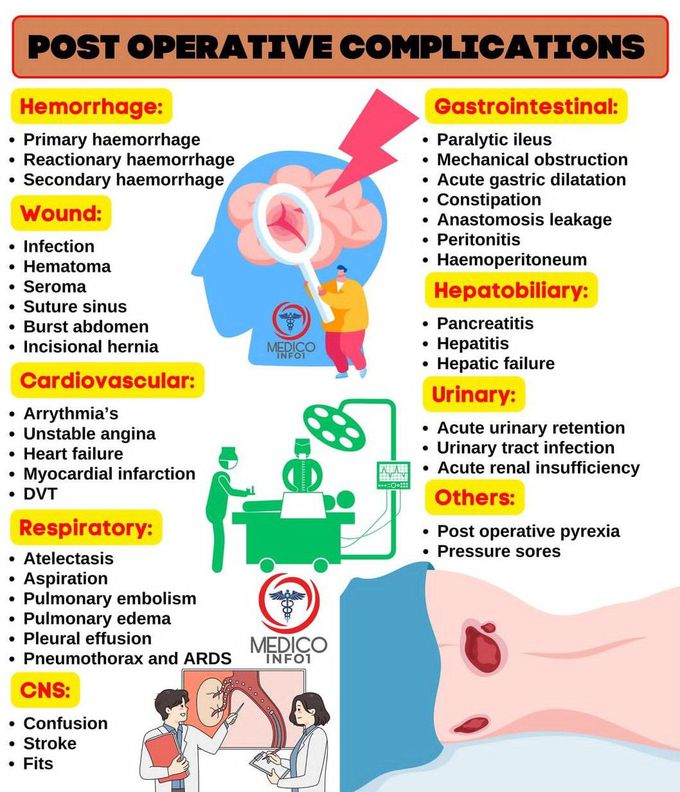 Post Op Complications