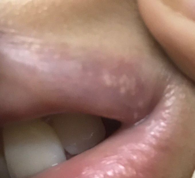 Can anybody diagnose this?