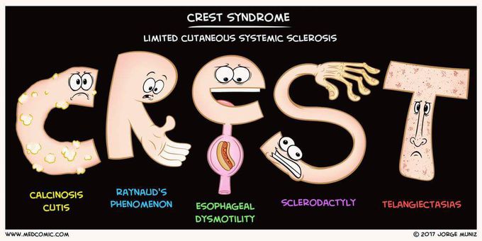 CREST syndrome