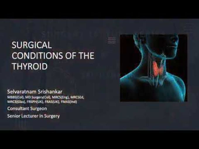 Overview of 
thyroid surgcal
conditions