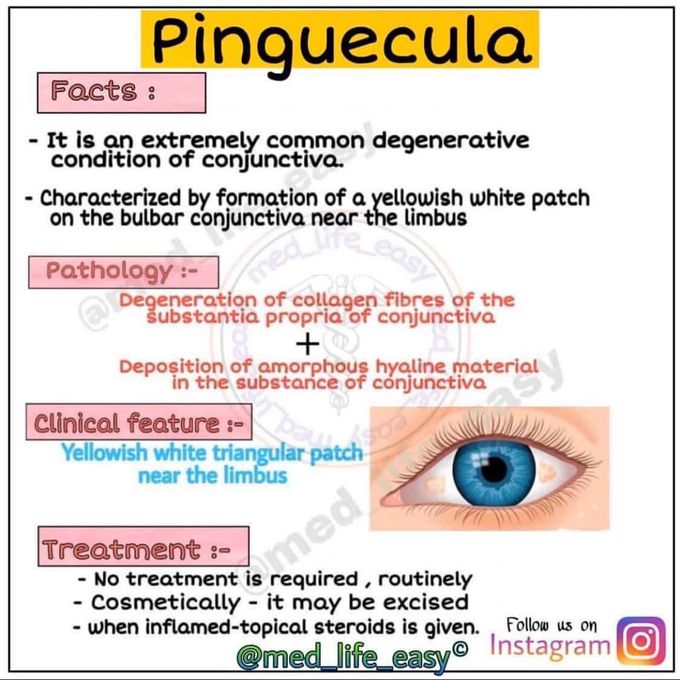 Pongeuecula