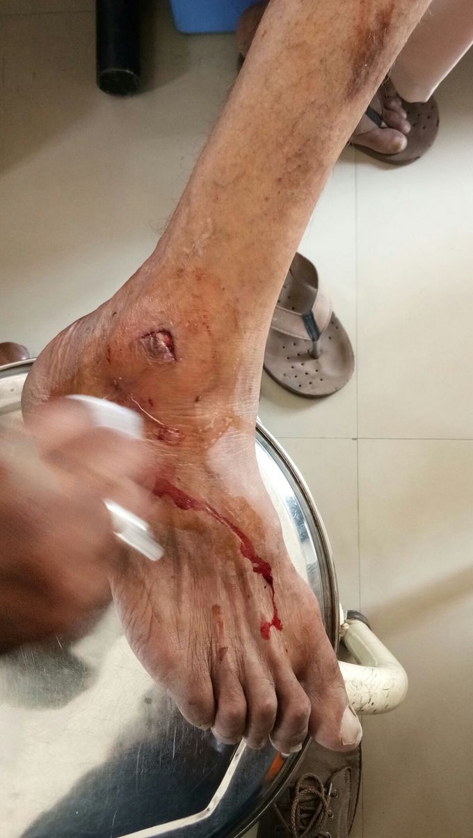 Injury