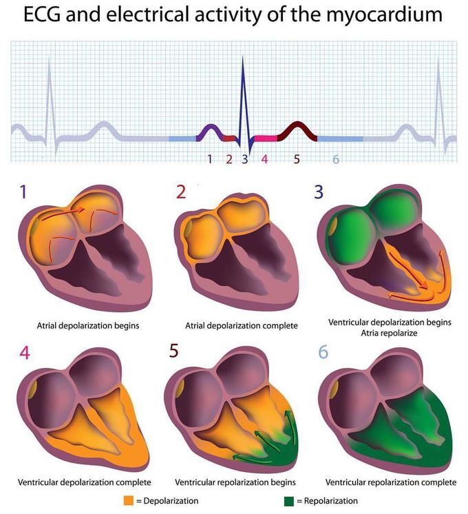 Understand the different waves generated by the ECG