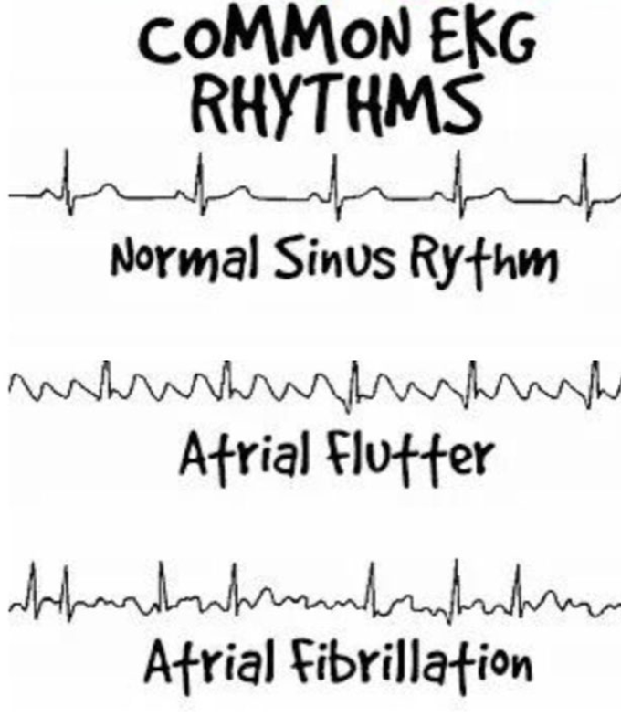 Heart rhythms
