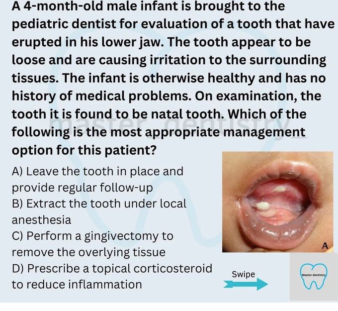 Identify the Management