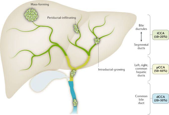 Cholangiocarcinoma symptoms