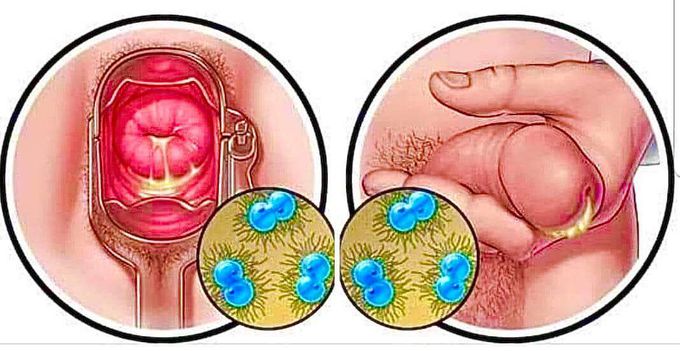 Diagnosis and Treatment ⁉️⁉️