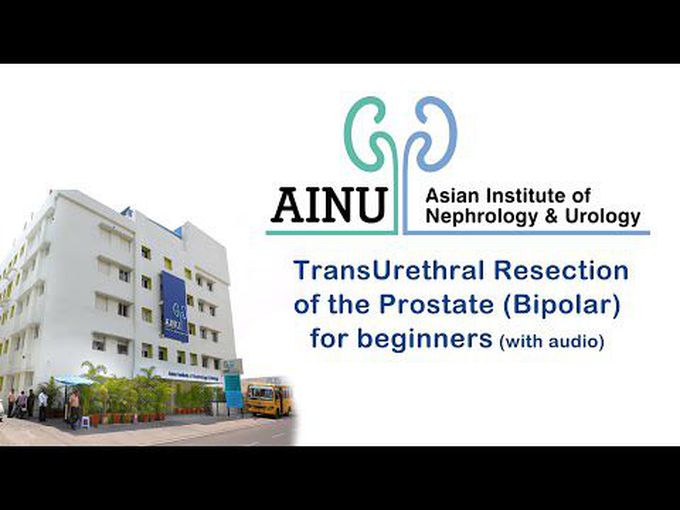 Transurethral Resection of Prostate