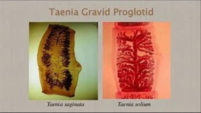 Lab diagnosis and treatment for Taeniasis