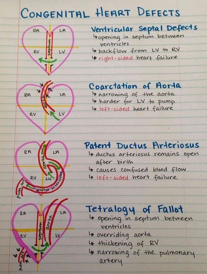 CHD (Congenital Heart Diseases )